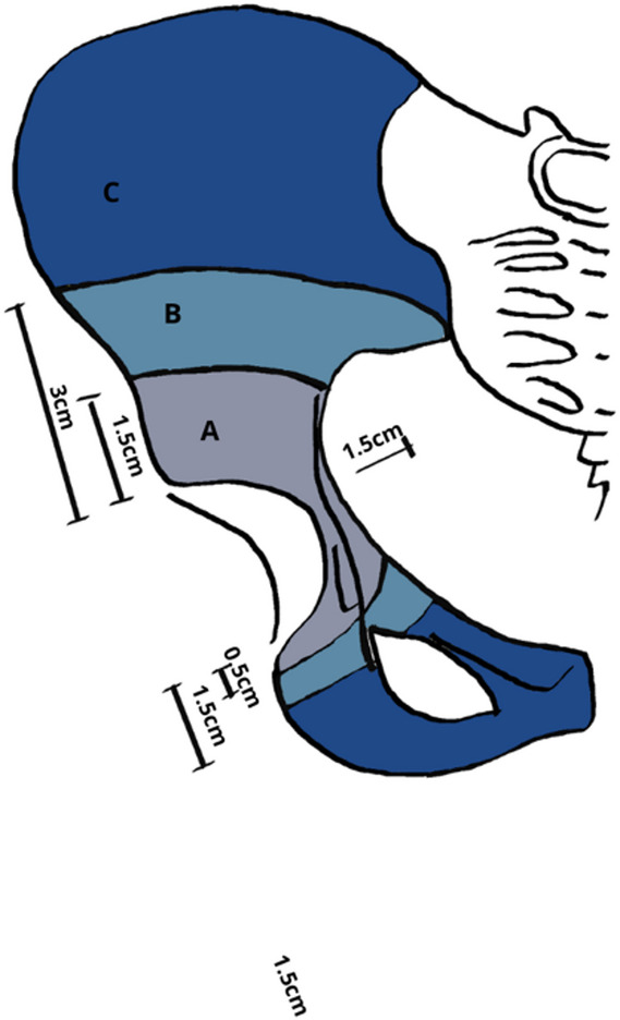 Figure 17