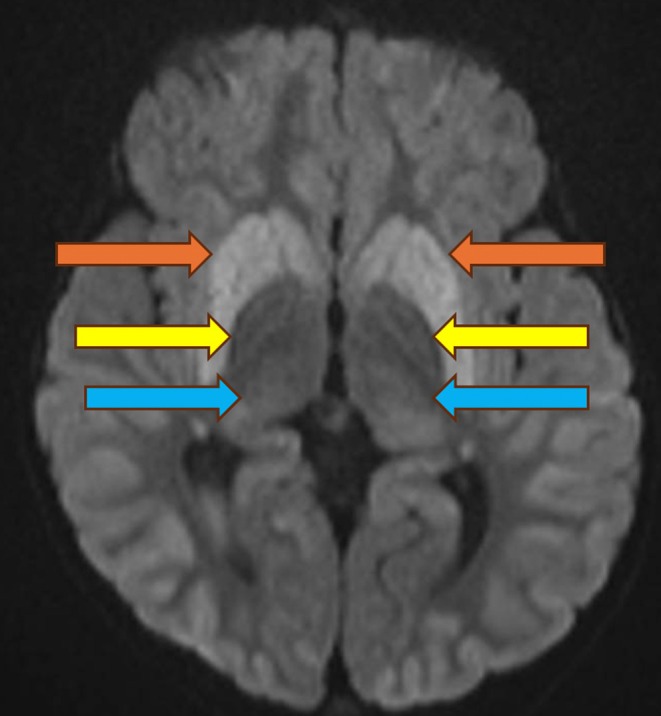 FIGURE 3