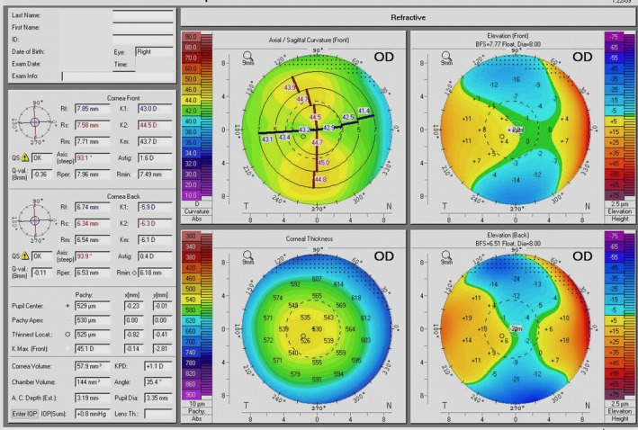 FIGURE 1
