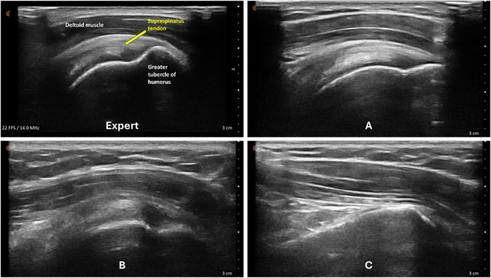 FIGURE 3