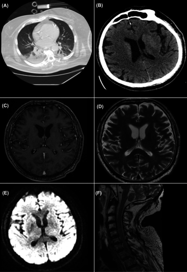 FIGURE 1