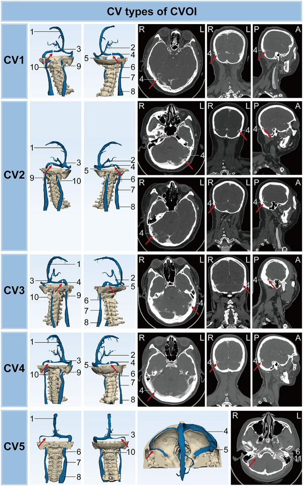 FIGURE 3