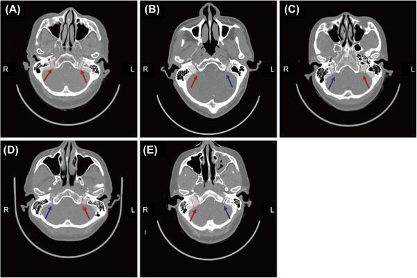 FIGURE 1