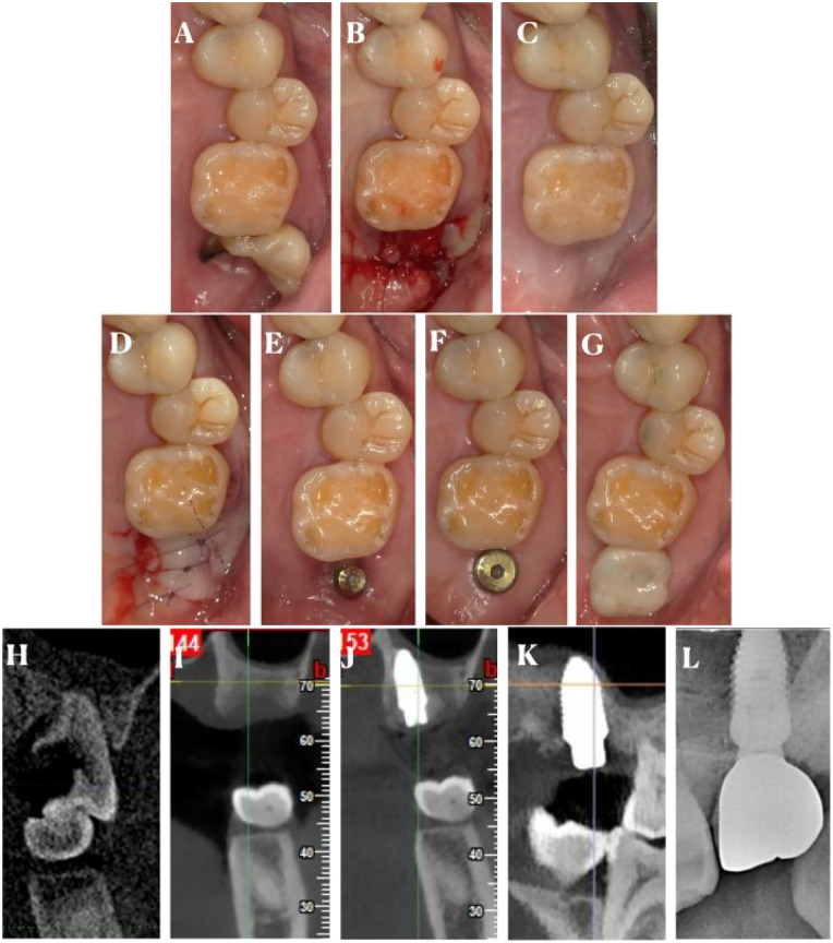 Figure 2