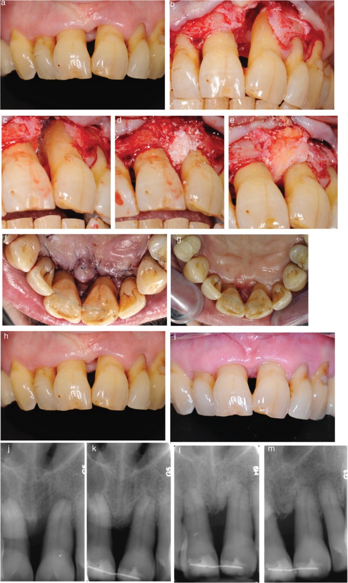 FIGURE 3