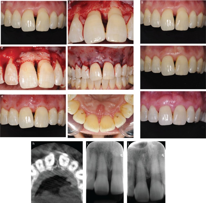 FIGURE 1