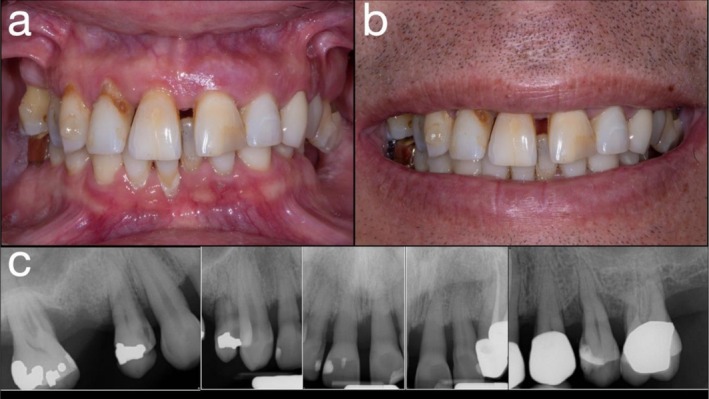 FIGURE 1