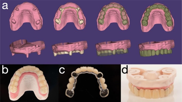 FIGURE 3