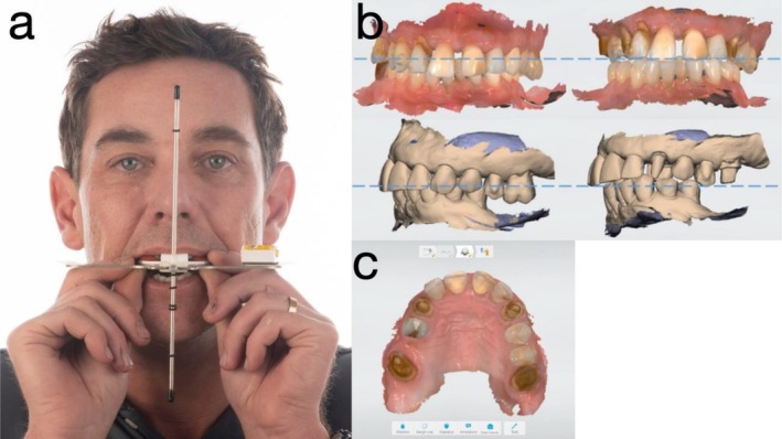 FIGURE 2