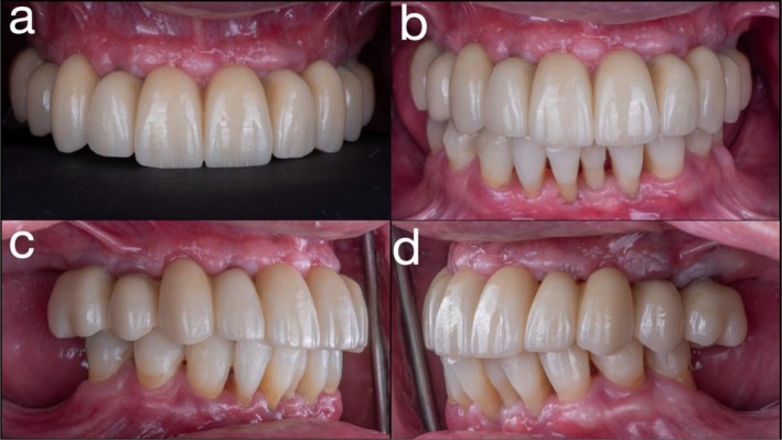 FIGURE 10