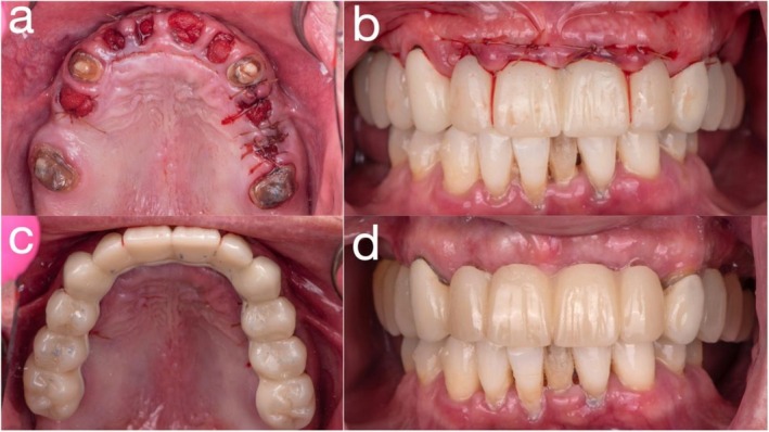 FIGURE 5