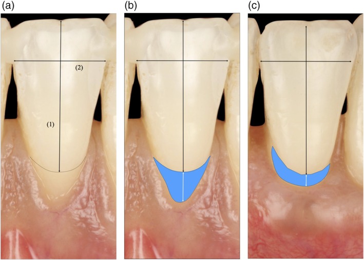 FIGURE 2