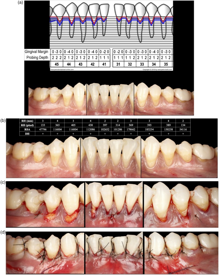 FIGURE 1