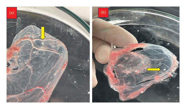 FIGURE 3