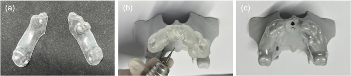 FIGURE 3