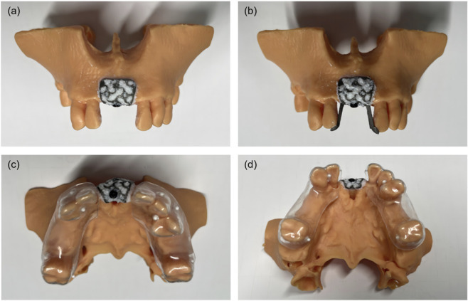 FIGURE 4