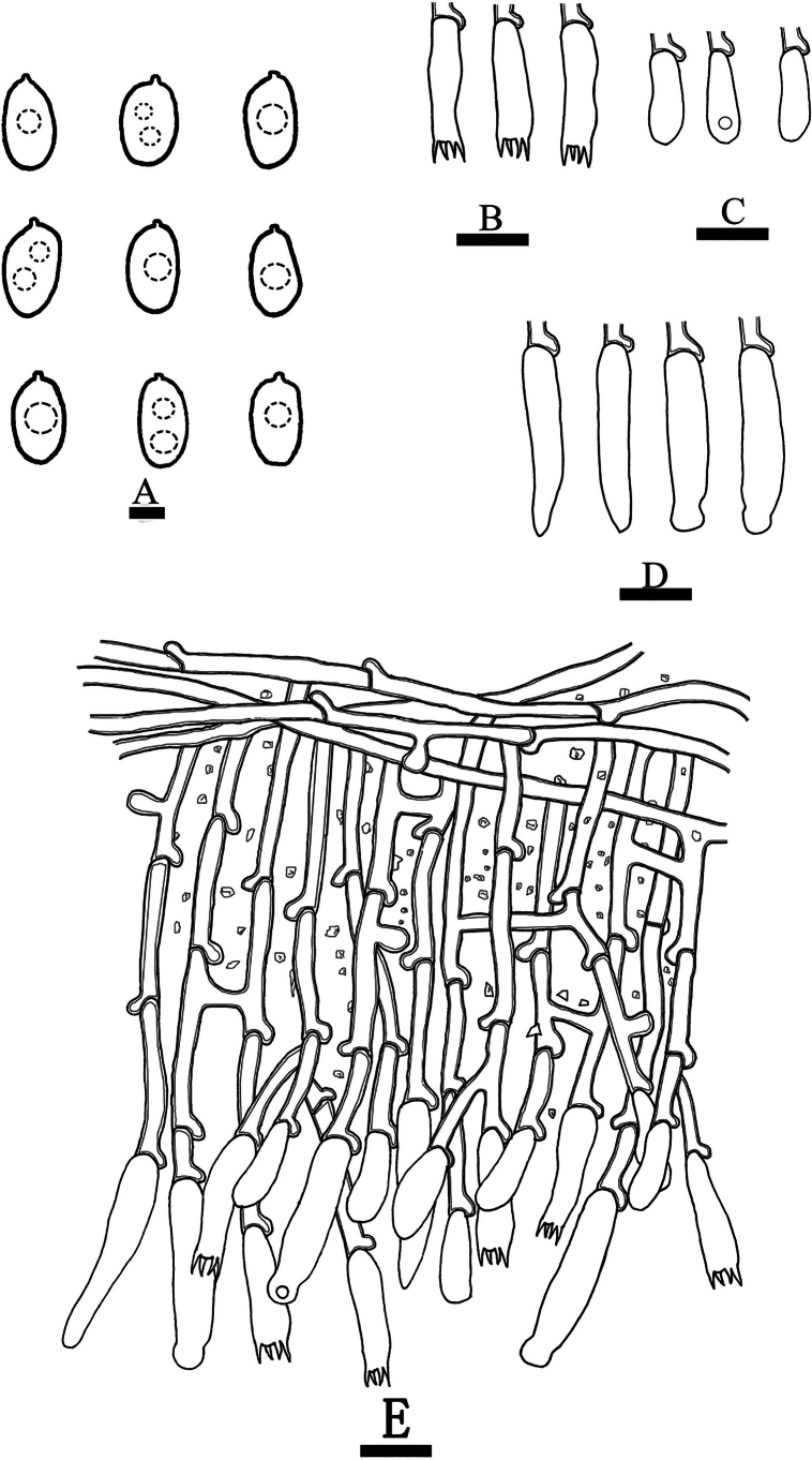 Figure 11