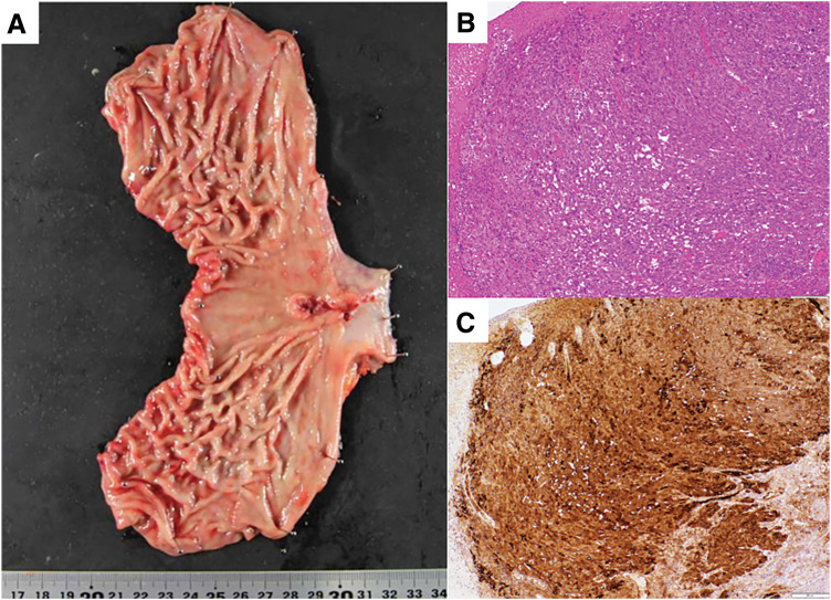 Fig. 4