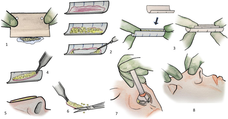 Figure 1
