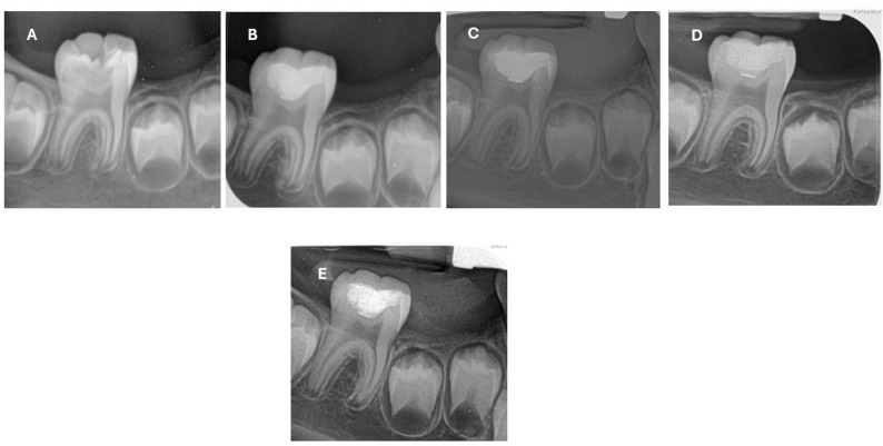 Figure 5