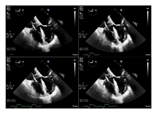 FIGURE 3