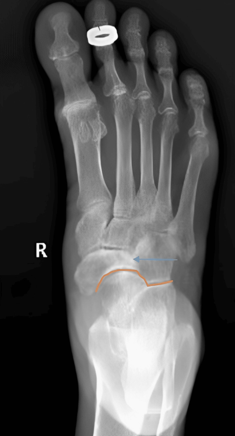Figure 7