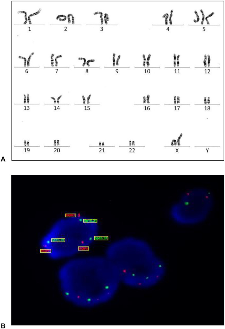 Fig 3