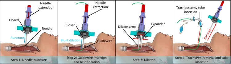 Fig 2
