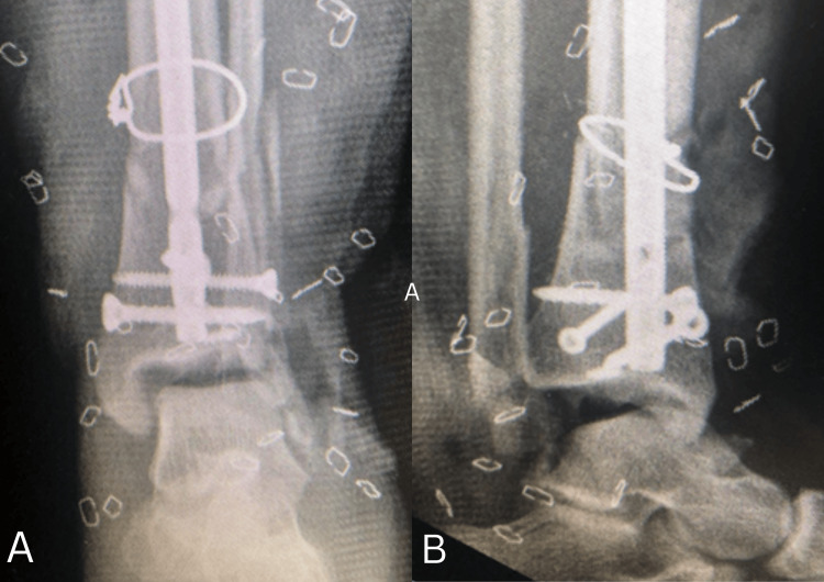 Figure 5