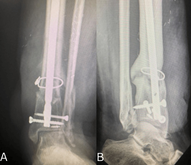 Figure 6