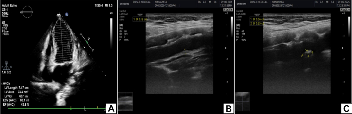 Figure 4