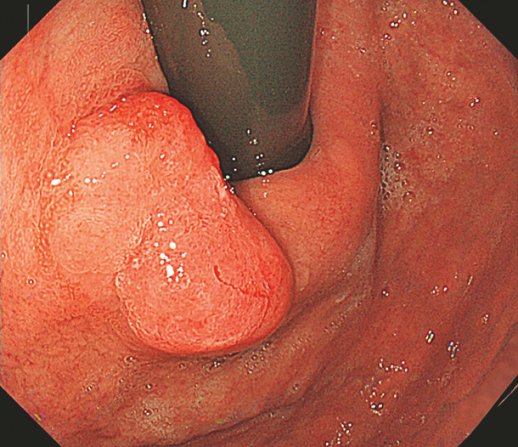 Fig. 1