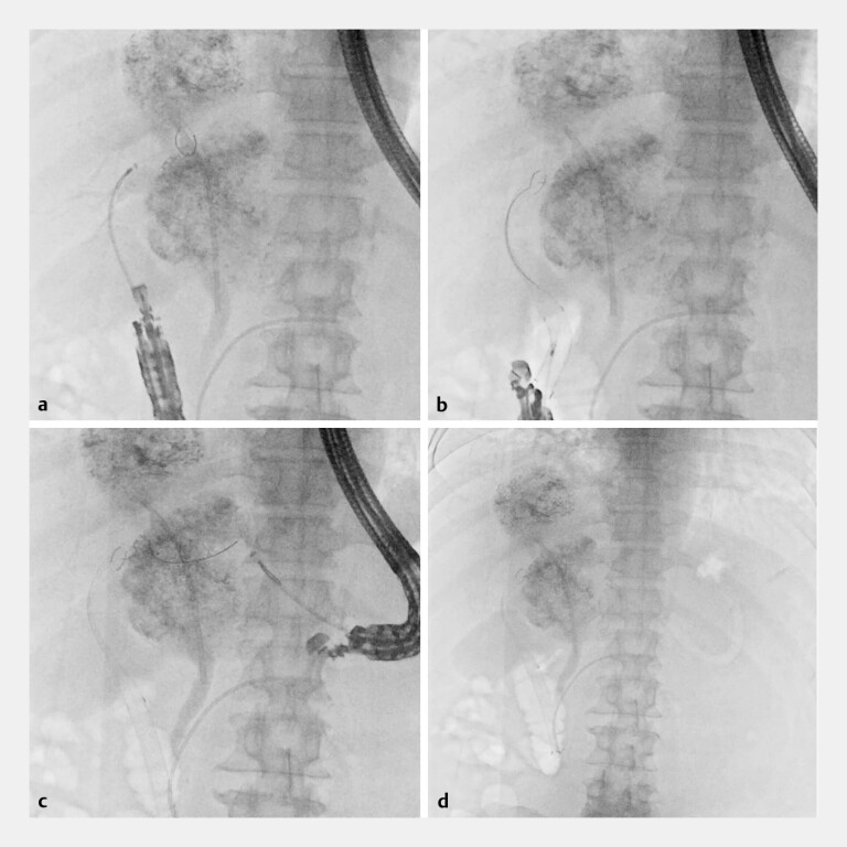Fig. 4