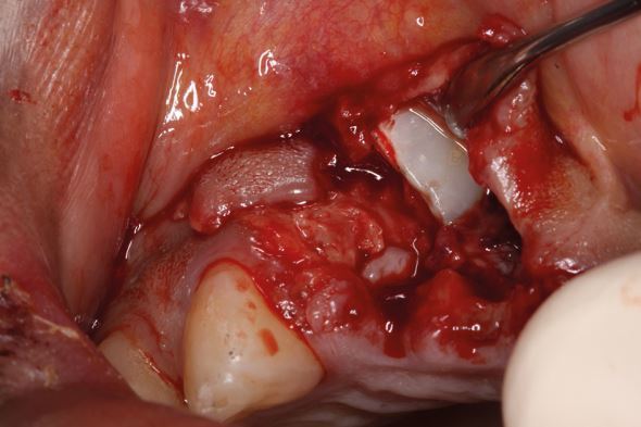 Figure 17