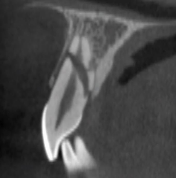 Figure 22