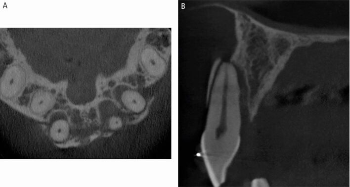 Figure 23