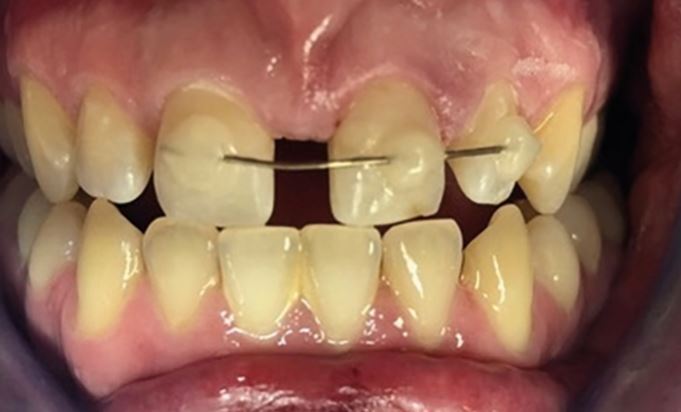 Figure 28