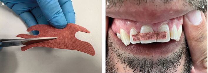 Figure 29