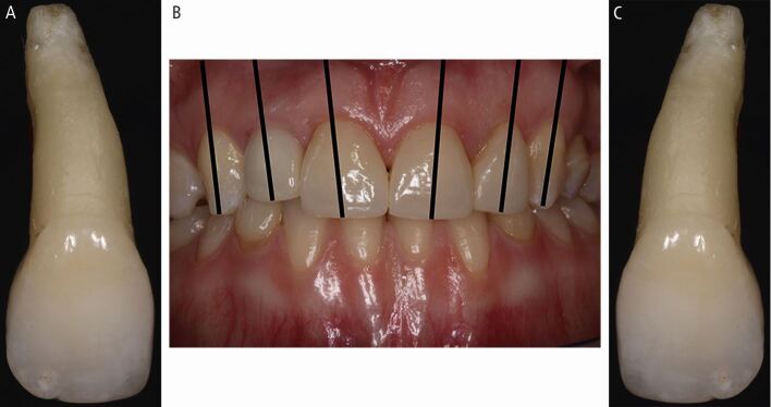 Figure 31