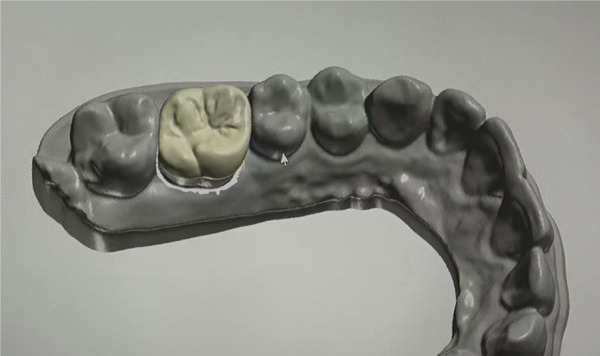 Figure 10