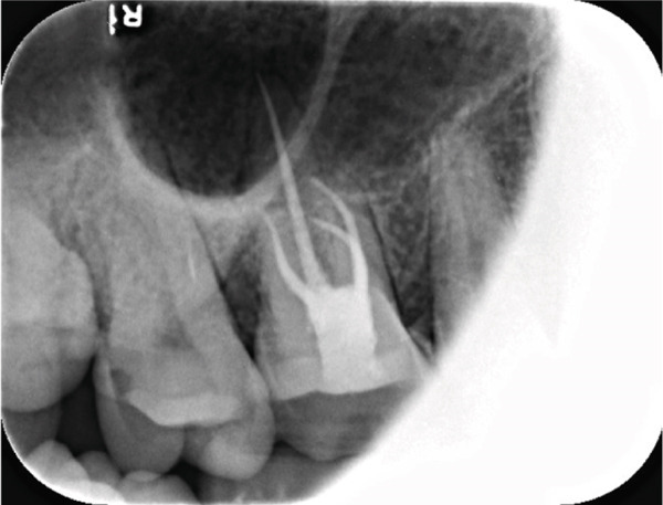 Figure 11