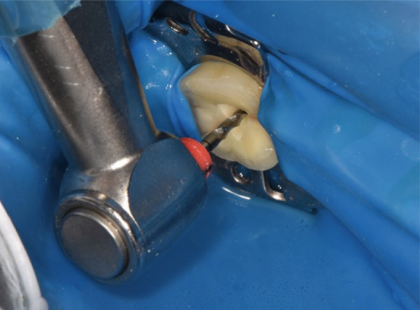 Figure 12