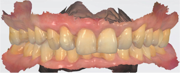 Figure 14