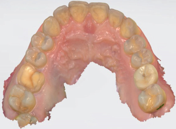 Figure 15
