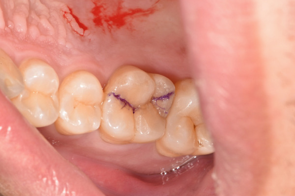 Figure 17