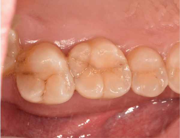Figure 18
