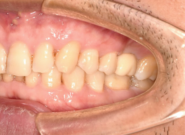 Figure 19