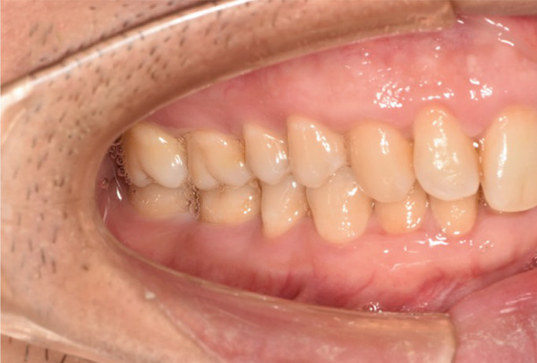 Figure 20