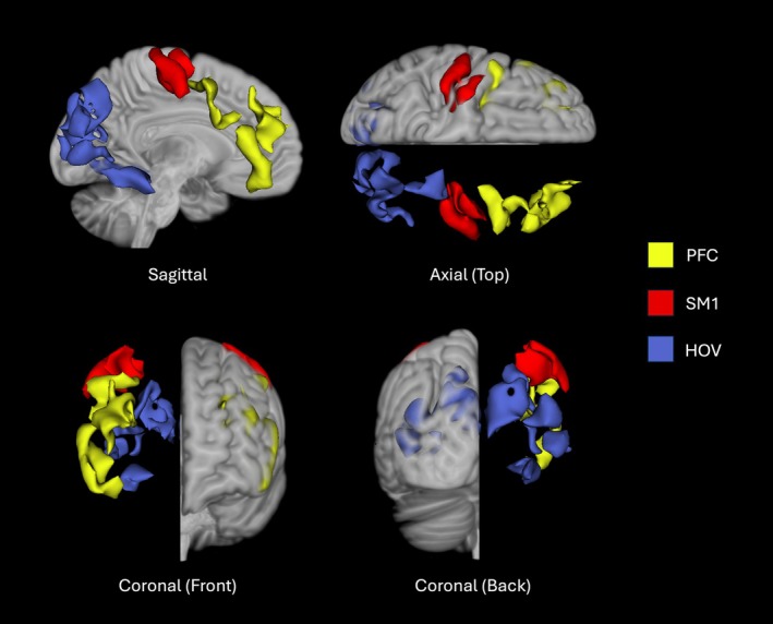 FIGURE 1