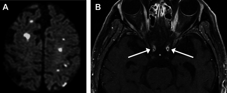 Figure 11